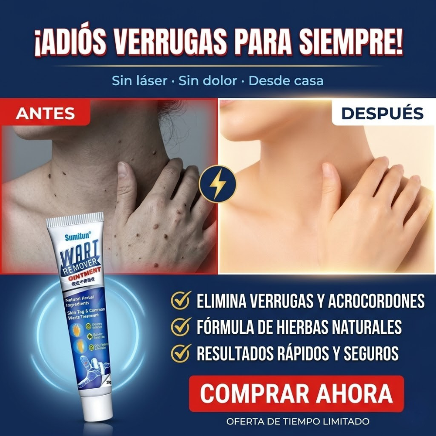 Wart Remover Pro – Elimina Verrugas desde la Raíz