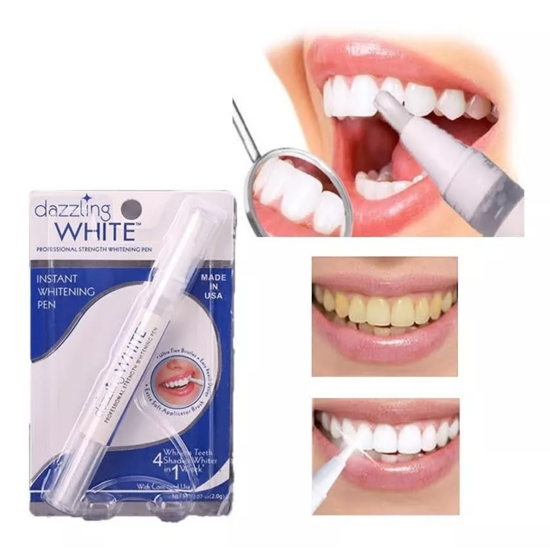Lápiz Blanqueador de Dientes Instantáneo – Sonríe con Confianza