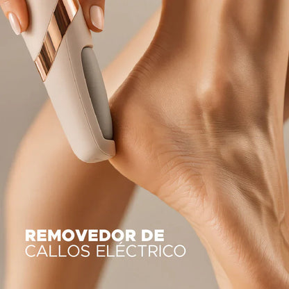 Removedor de Callos SoftFeeet Pro
